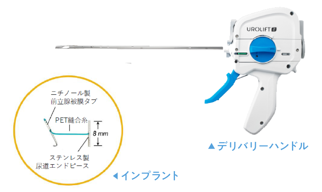 前立腺切除術と放射線療法の比較